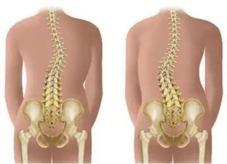 醫(yī)用數(shù)字X射線攝影系統(tǒng)可開(kāi)展全脊柱及下肢全長(zhǎng)拼接攝影技術(shù)