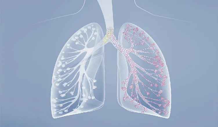 如何讓高流量呼吸濕化治療儀發(fā)揮更好的作用？（I型呼衰患者必讀）