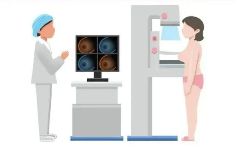 乳腺鉬靶查什么？哪些人需要做乳腺鉬靶